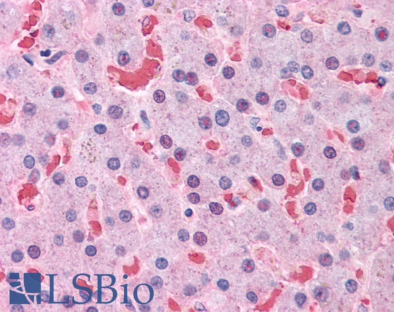 IHC-plus™ HBB / Hemoglobin Beta Antibody (clone 7B12)