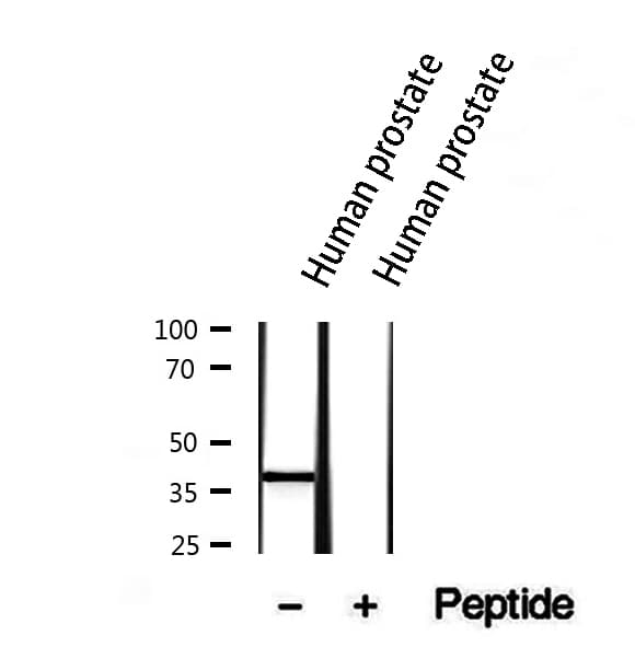 Polyclonal Rabbit anti-Human NKX3-1 Antibody (IHC, WB)