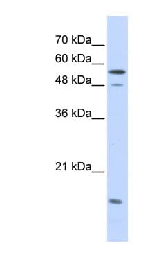 Polyclonal Rabbit anti-Human KPNA2 / Importin Alpha 1 Antibody (aa323-372, WB)