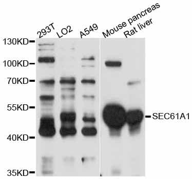 Polyclonal Rabbit anti-Human SEC61A1 / SEC61 Antibody (WB)