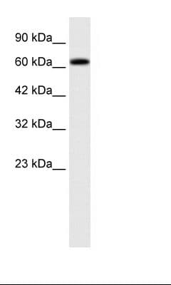 Polyclonal Rabbit anti-Human SPRING / TRIM9 Antibody (C-Terminus, IHC, WB)
