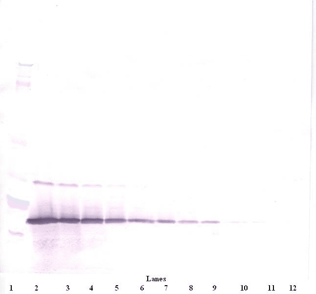 Polyclonal Rabbit anti-Human IL21 Antibody (IHC, WB)
