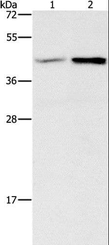 Polyclonal Rabbit anti-Human GB5 / GNB5 Antibody (IHC, WB)
