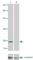 Monoclonal Mouse anti-Human DCTD / dCMP Deaminase Antibody (clone 4B9, WB)