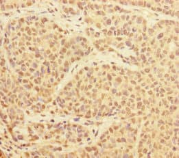 Polyclonal Rabbit anti-Human PRPF4 Antibody (IHC, WB)