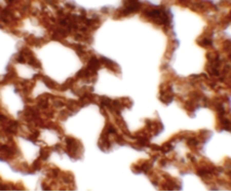 Polyclonal Rabbit anti-Human NETO1 Antibody (IHC, IF, WB)