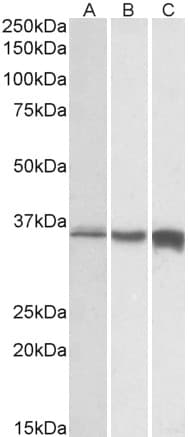 IHC-plus™ TNNT3 Antibody (aa232-246)