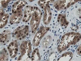Dipeptidyl Peptidase 3 / DPP3 Antibody (clone OTI2D9)