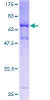 Human MAGEA11 Protein (Recombinant GST)
