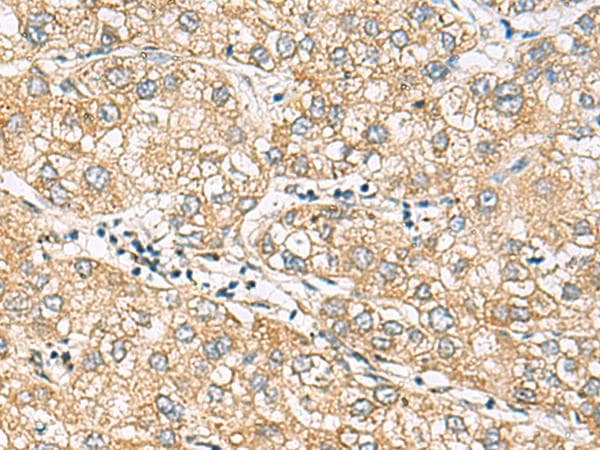 DACT3 Antibody
