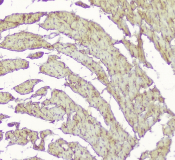 Polyclonal Rabbit anti-Human CKM / Creatine Kinase MM Antibody (IHC, WB)