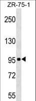 c-Kit / CD117 Antibody (aa691-720)