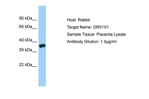 Polyclonal Rabbit anti-Human OR51V1 Antibody (aa206-255, WB)