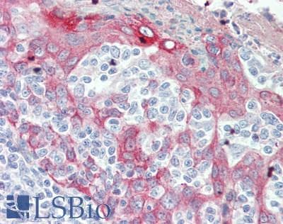 IHC-plus™ Polyclonal Rabbit anti-Human KRT34 / Keratin 34 / KRTHA4 Antibody (aa1-303, IHC, IF, WB)