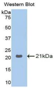 GAA / Alpha-Glucosidase, Acid Antibody (aa761-919)