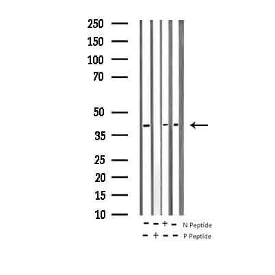 Polyclonal Rabbit anti-Human MAP2K3 / MEK3 / MKK3 Antibody (phospho-Ser189, IHC, IF, WB)
