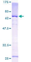 Human KCNAB1 Protein (Recombinant GST)