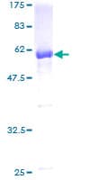 Human CAB39L Protein (Recombinant GST)