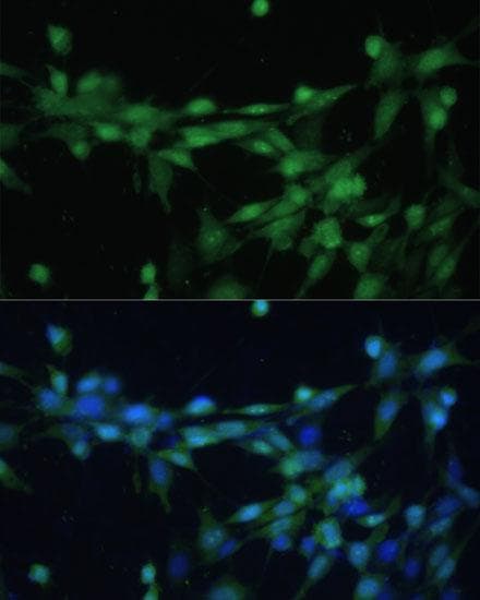 CSNK2B / Phosvitin Antibody