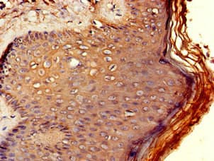RCBTB2 Antibody