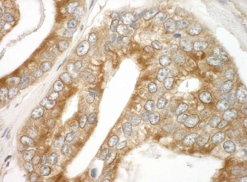 Polyclonal Rabbit anti-Human MAPRE1 / EB1 Antibody (aa245-268, IHC, IF)