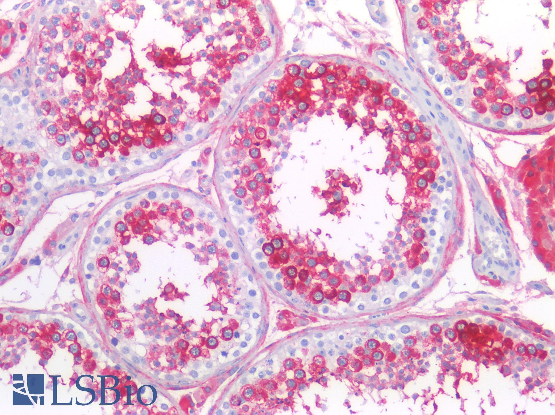 PathPlus™ Monoclonal Mouse anti-Human APCS / Serum Amyloid P / SAP Antibody (clone 7F3, IHC, WB)
