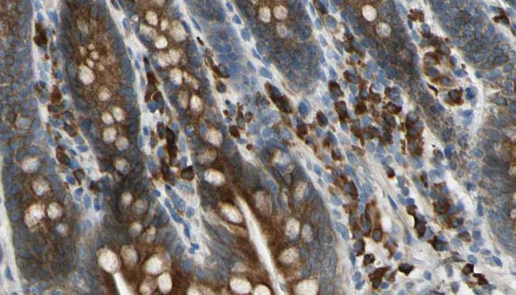 GPR158 Antibody