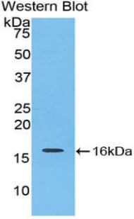 IL16 Antibody (aa1203-1322)