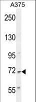 ALS2CR11 Antibody (aa152-181)
