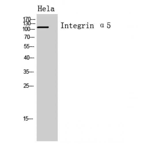ITGA5/Integrin Alpha 5/CD49e Antibody (561-610 aa, Internal)