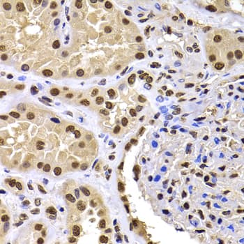 Polyclonal Rabbit anti-Human HIRIP3 Antibody (IHC, IF, WB)