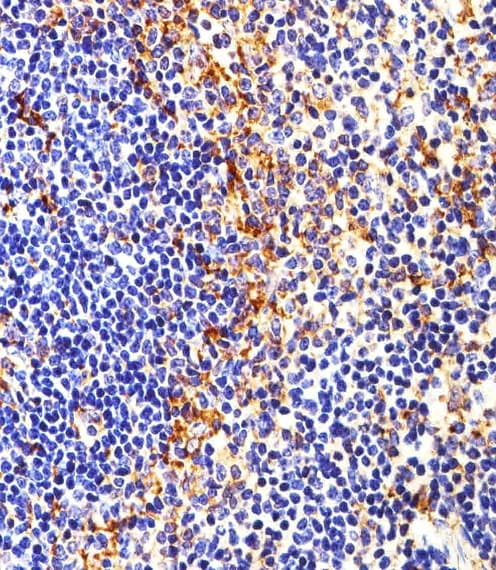 SYN / FYN Antibody (clone 1302CT390.118.237)