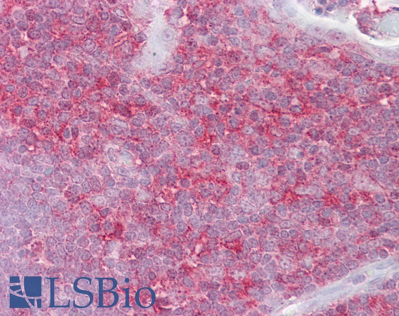 Polyclonal Rabbit anti-Human KIF2A Antibody (aa72-121, IHC, WB)