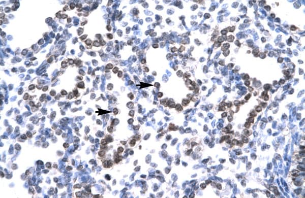 Polyclonal Rabbit anti-Human HEY1 Antibody (aa197-246, IHC, WB)