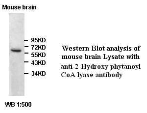 IHC-plus™ HACL1 Antibody