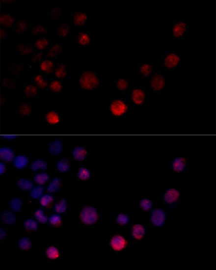 Polyclonal Rabbit anti-Human HNRNPH2 / hnRNP H2 Antibody (IF, WB)