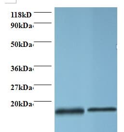 PFN1 / Profilin 1 Antibody