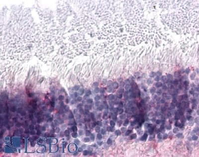 IHC-plus™ NR2E3 / PNR Antibody (Ligand-binding Domain)