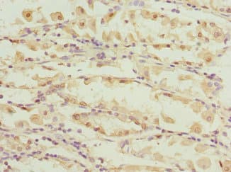 CAPNS1 / CAPN4 Antibody