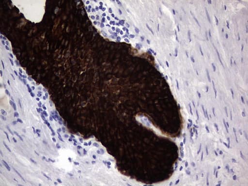 KRT19 / CK19 / Cytokeratin 19 Antibody (aa240-390, clone OTI8A1)