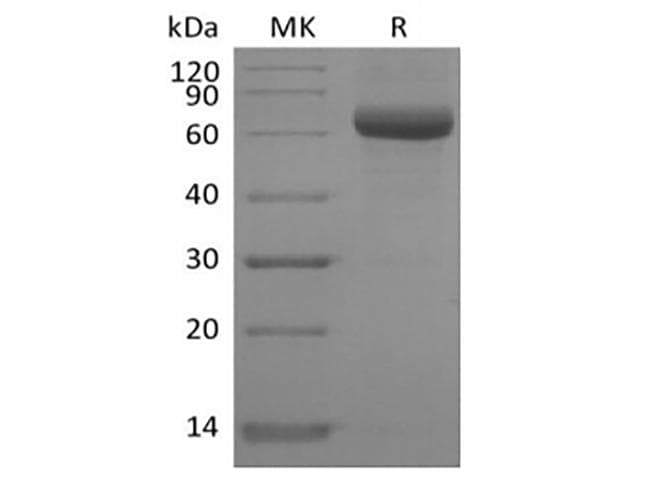 Human SIGLEC15 Protein (Recombinant Fc-AVI, C-terminus)