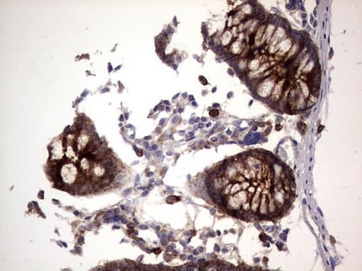 Monoclonal Mouse anti-Human CEACAM5 / CD66e Antibody (clone OTI3D8, aa35-680, IHC, WB)