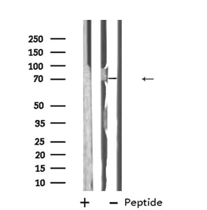 Polyclonal Rabbit anti-Human ABCG5 Antibody (IHC, WB)