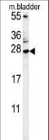 Polyclonal Rabbit anti-Human MUTED Antibody (aa40-68, IHC, WB)