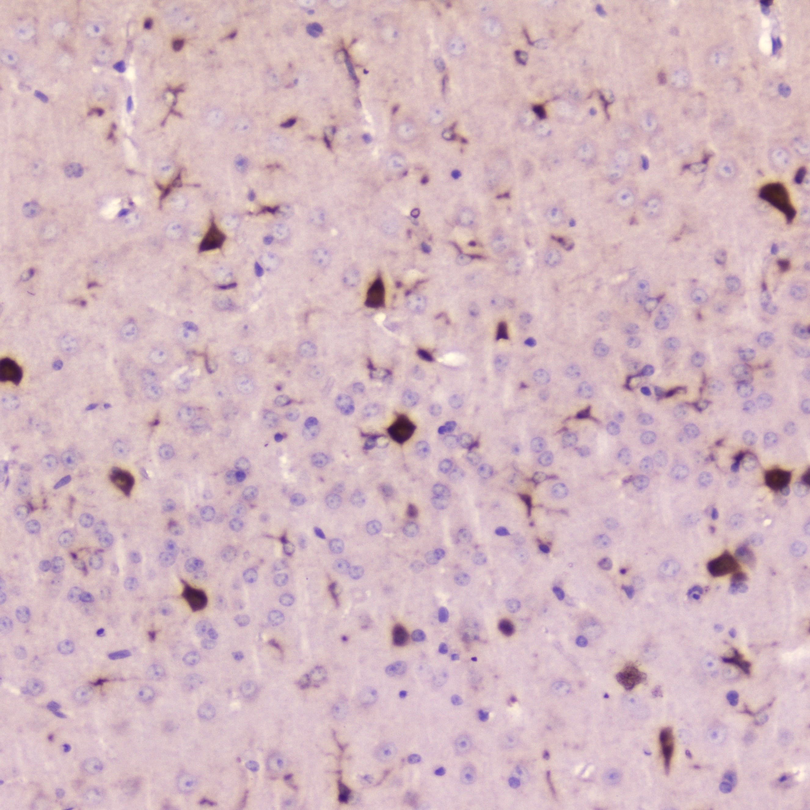 CST3 / Cystatin C Antibody