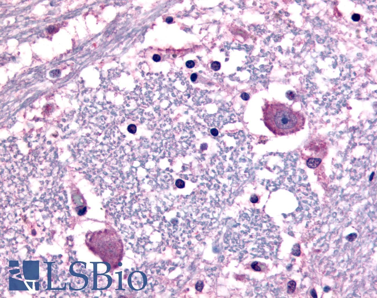 PathPlus™ CRFR1 / CRHR1 Antibody (N-Terminus)
