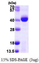 Human PCA1 / ALKBH3 Protein (Recombinant His)