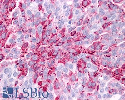 PathPlus™ GPR34 Antibody (C-Terminus)
