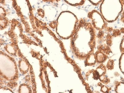 EPCAM Antibody (aa100-224, clone EGP40/2041R, Azide-free, Carrier-free)