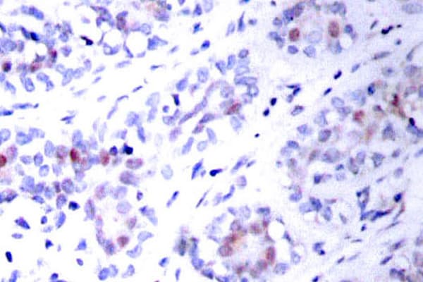 STAT3 Antibody (Thr721)